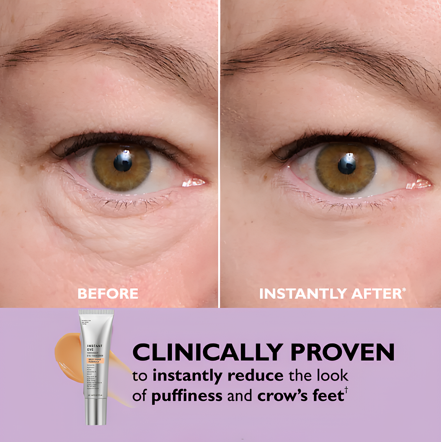 Instant Eye Tightener